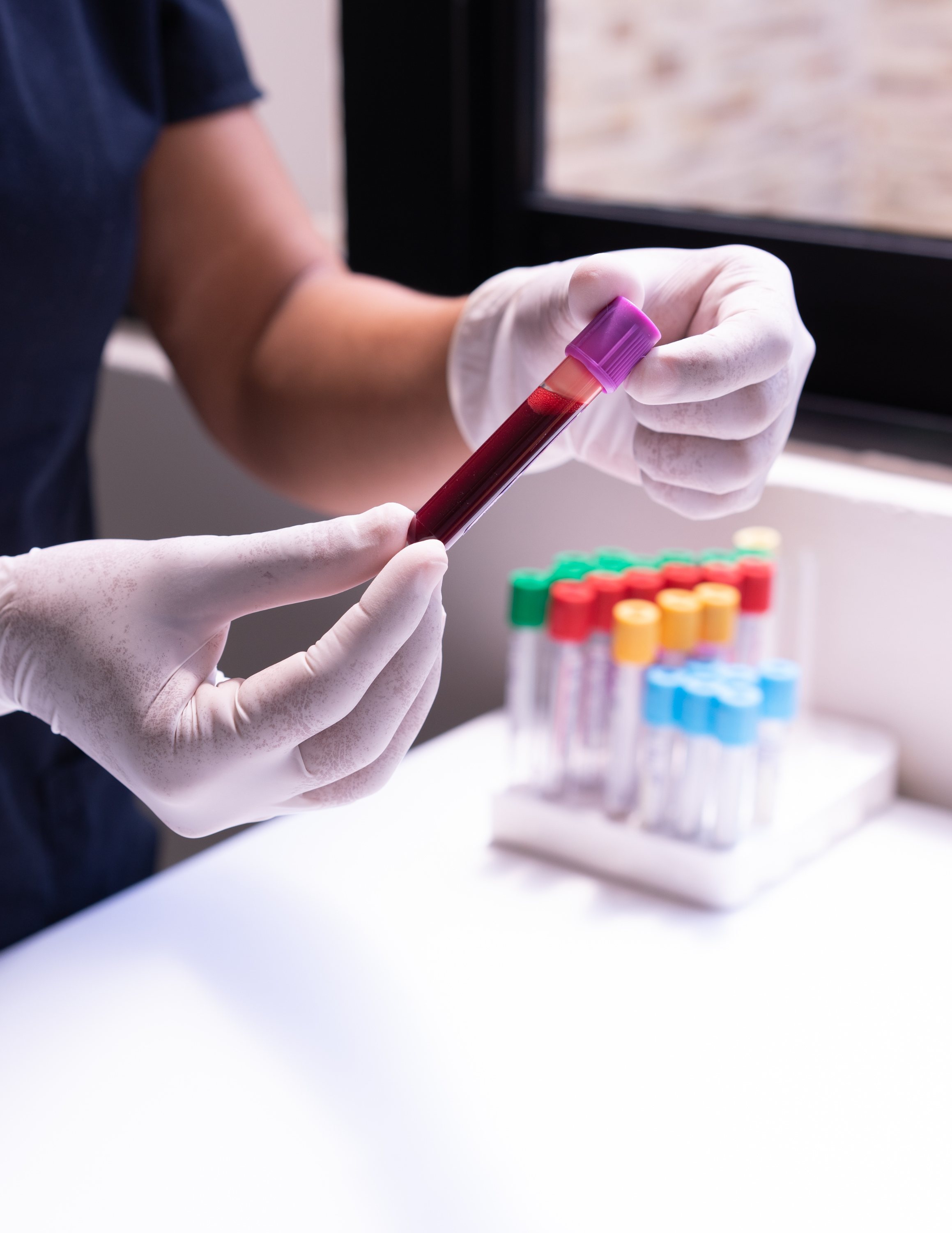 Workplace Drug Testing and Background Checks