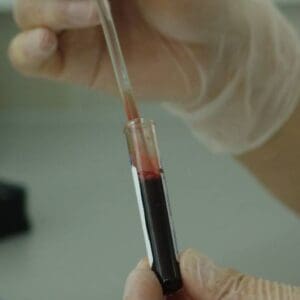 A person holding a syringe with blood in it.