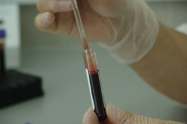 A person holding a syringe with blood in it.