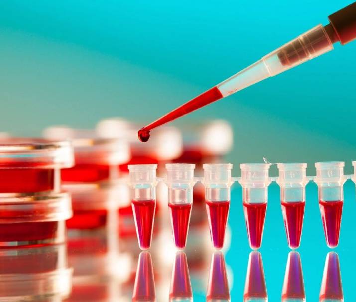 A person is filling out blood samples in a lab.