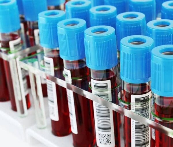 A close up of blood samples in tubes